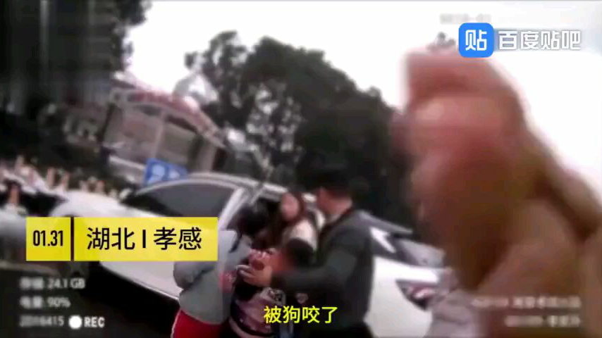 声称自己的狗不咬人,结果她的儿子被狗咬的头破血流也没有去教训狗